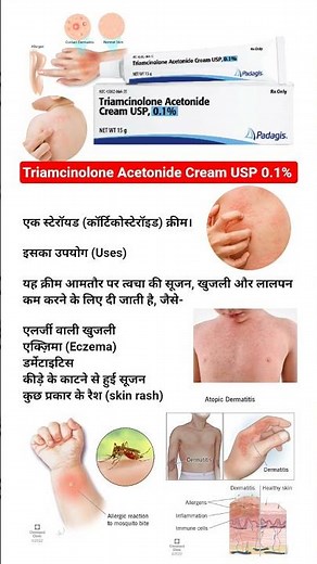 Triamcinolone Acetonide Cream USP 0.1% ... use