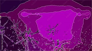 2d animation in comic style - Concept of Cancer Cell in human body Stock Video