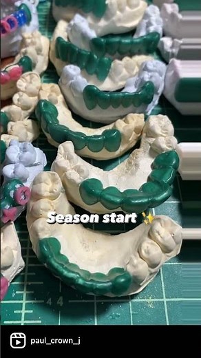 Making Gold teeth Grillz