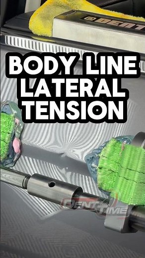 Lateral Tension on Deep Body Line