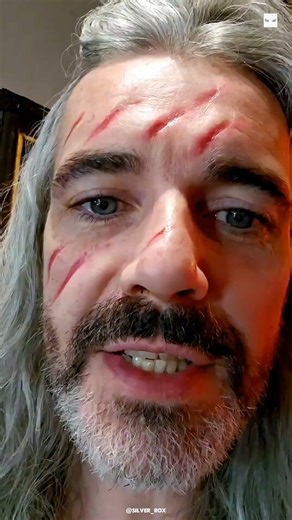 This Scar Looks FAKE… But It’s Not 😳#shorts