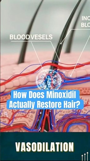 How does Minoxidil actually restore your hair? Science explained #hair #hairlosstreatment #Minoxidil