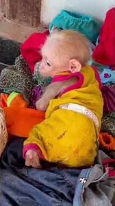 A BABY MONKEY RUN FOLLOW ITS OWNER. #monkey #monkeysr #babymonkey #cute #animals #monkeybusiness