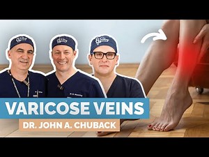 Ultimate Treatment Guide For Varicose Veins. Vascular Surgeon Explains