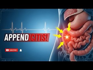 “Appendicitis EXPLAINED: What Happens Inside Your Body (3D Medical Animation)”