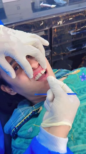 Natural Closure of Incisor Gap with Comfortable Dental Treatment