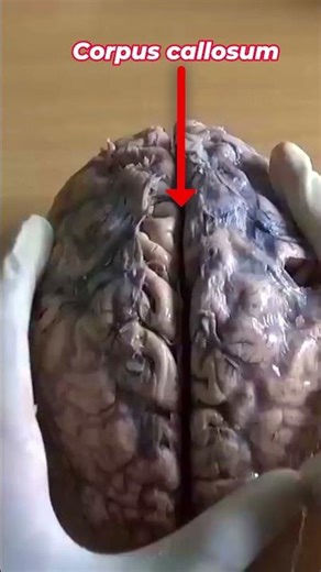 Human Brain Parts Explained #brains #science #anatomy #medicalshorts