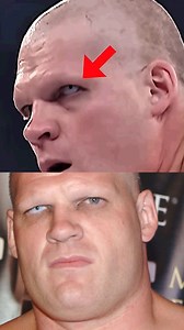 What’s Wrong With Kane’s Eye?👀 #wwe #kane #undertaker #WWELegends | GameSlam Tamil