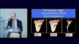 Glenoid & Scapula Fxs