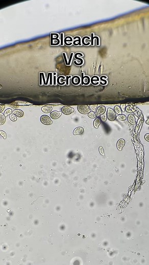 2.8M views · 18K reactions | Bleach VS Microbes #foryou #science #microscope | Justice Dodson Microscopy | Facebook