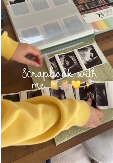 Baby's First Scrapbook: Ultrasound Memories