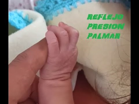 Palmar Grip Reflex