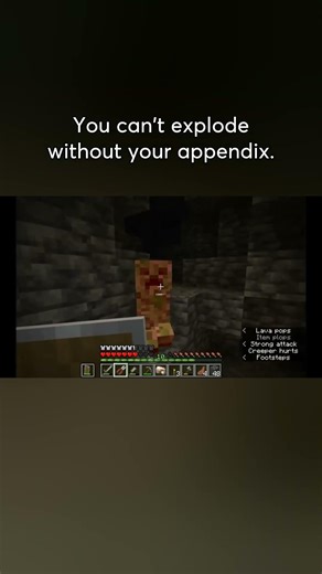 I DISARMED a Creeper 😂💣 No Boom Allowed | Chest Cavity Mod | The Dadcrafter