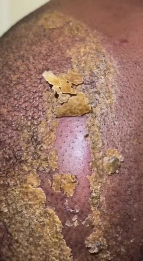 296K views · 467 reactions | Dandruff asmr scratching removal on head using combing (25) | toktok.tv | Facebook