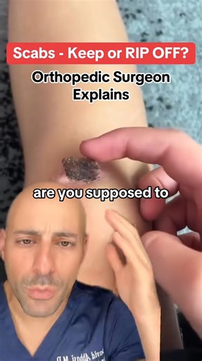 David Abbasi, MD | Orthopedic Sports Surgeon on Instagram: "Are you supposed to rip off your scab? Doctor reveals the truth! #healthtips #surgeon ✅Follow @drdavidabbasi for More Daily Medical Content & Health Tips! 🌴😷Schedule a consultation to see Dr. Abbasi as a patient in Delray Beach! Visit www.primeorthocenter.com"