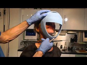 First Stage-p3 of MewVector Orthodontic Orthotropics Headgear (Head Brace) Preparation- Dr Mike Mew