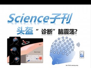 【传感器】多角度传感器阵列（李雪迪）251018