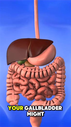 5 Warning Signs of Gallbladder Disease You Shouldn’t Ignore #gallbladderhealth #gallbladderdisease #DigestiveHealth #gallstones #GallbladderDisease #healthyeating #upperabdominalpain | Health Doctors