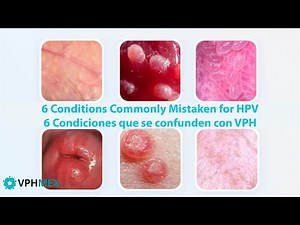 6 Conditions Commonly Mistaken for HPV.