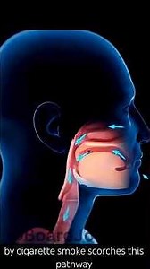 Why Smokers Get Sleep disorder: The Airway Collapse🫁