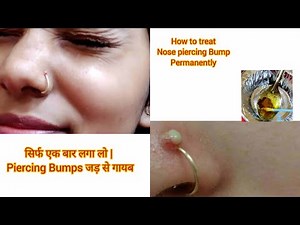 How to remove nose piercing bumps /Home remedies to remove bump / Get rid of nose piercing bump fast