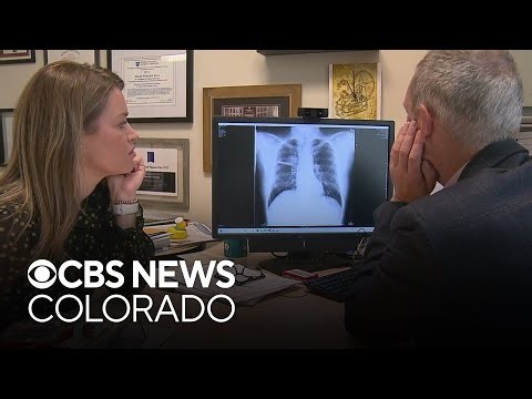 Colorado lung cancer doctor Ross Camidge reveals his own diagnosis to help others