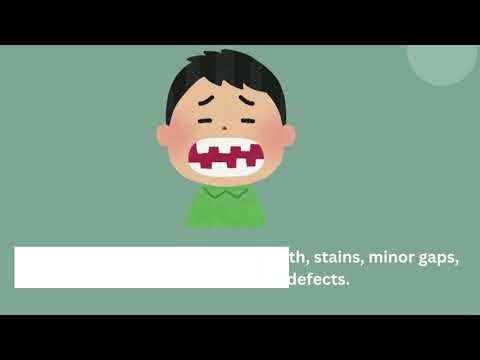 How Pediatric Dentists Repair Chipped or Discolored Teeth (Cosmetic Bonding)