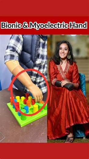 Bionic And Myoelectric Hand #artificialhand #shortvideo #shortsfeed #ytshorts #foryou #fypp #shorts