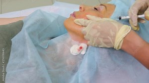 Aged woman doing mesothreads and Thread Lifting, Cosmetology. Cosmetic procedure to eliminate signs of aging. Beauty Face, Facial contour, plastic surgery concept for Age 40-50 years.