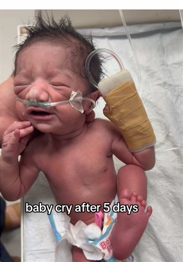 Understanding Baby Crying Patterns After 5 Days