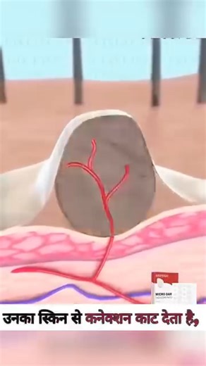 33K views · 37 reactions | Say goodbye to unwanted skin tags and...