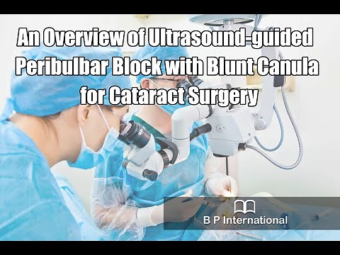 An Overview of Ultrasound-guided Peribulbar Block with Blunt Canula for Cataract Surgery