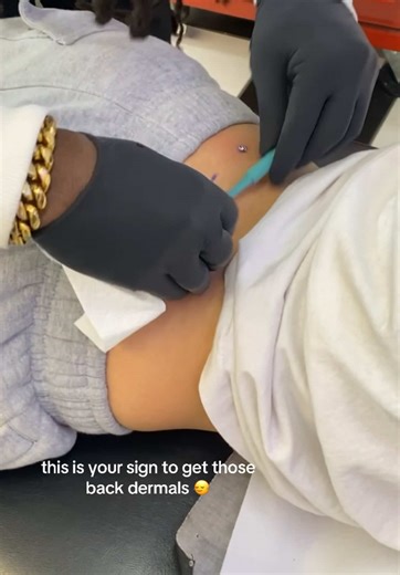 Celebrate 2 Years of Back Dermals: Pain and Style