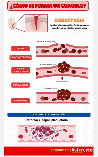 Formación de Coágulos: Hemostasia y Cascada de Coagulación
