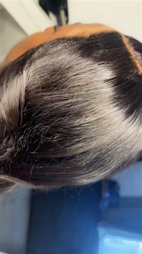 Wig where??? Watch glueless wig and scalp become one. HD lace wig install in 20 secs#hair #wigs