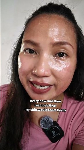 The secret to my happy skin | Acne Fighter talks