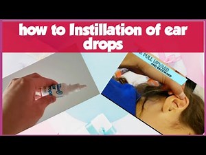 Proper instillation of ear drops