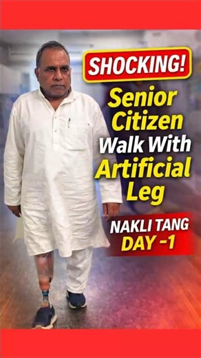 Below knee Artificial Leg Price | Prosthetic Leg For Senior citizens | Nakli Tang #ossur #ampute