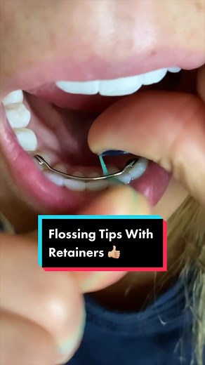 Effective Flossing Tips for Retainers | Dental Care Guide