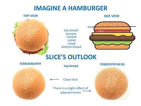 Tomosynthesis vs Tomography