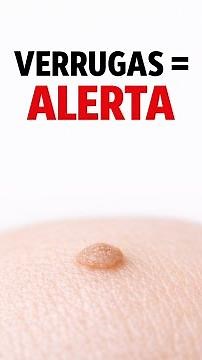¿Tienes verrugas? Podría ser una señal de prediabetes (casi nadie lo sabe)