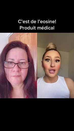 #Duo avec @fanny.scg Eosine, traitement médical pour la peau en cas de surinfection! #medical #eosine