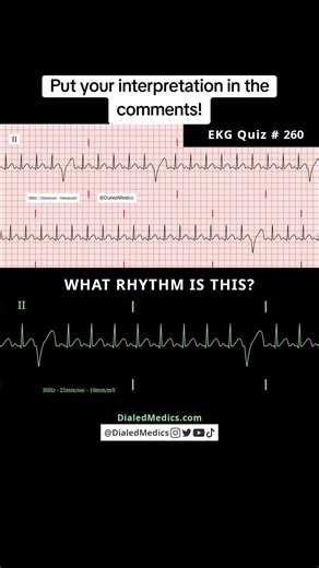 Practice EKG Recordings with Interactive Rhythm Generator