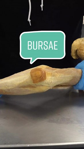 Bursitis is when it they become inflamed. #LearnOnTikTok #TikTokPartner #Bursa #HumanAnatomy