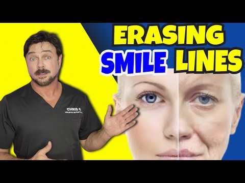 12 MINS🔥 FACE LIFT EXERCISES for Smile Lines & Lip Wrinkles! Try This