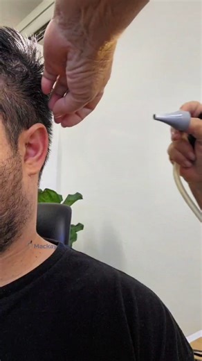 It's looking like a dead bug in his ear, but that is 100% earwax. If you think you have a blockage in your ear or it's interrupting your daily life, book an appointment with us today at Mackay Ears. | Mackay Ears