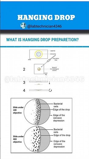 Hanging drop Motility test microbiology|hanging drop method|hanging drop preparation inHindi|Hanging