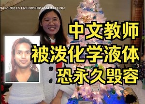 夏威夷一在美中文教师张丹英(Danying Zhang)被泼不明化学液体或永久毁容 美中友好协会：正筹集善款联系其农村父母 Hawaii 2024.1.29