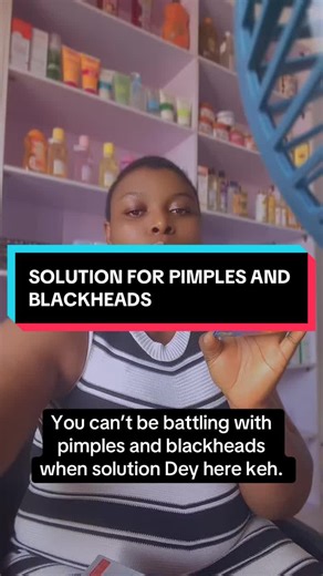 TREATMENT FOR PIMPLES AND BLACKHEAD #skincare #asabatiktokers #creatorsearchinsight #asabaskincarevendors #oxy10
