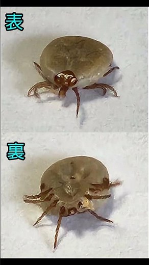 マダニと同棲、内ももを噛まれて気が付かず３日間虫と分からなかった。2日目位に何か付いてるな、とが、皮膚が剥けてるのかな、程度でそろそろ取るか？と取ったらこいつが動いてた。風呂に入った位じゃ分からない。